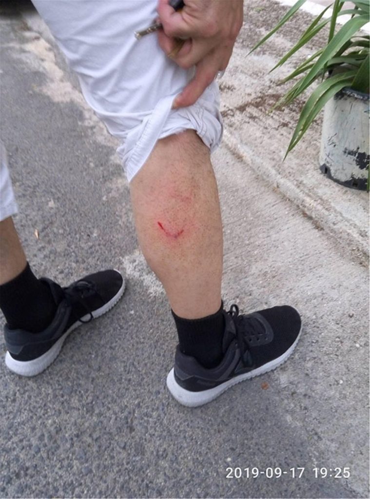 42χρονος στο νοσοκομείο από επίθεση αδέσποτων σκύλων (φωτο)