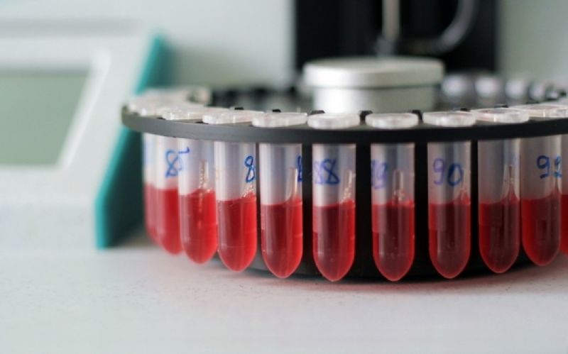 H σπανιότερη ομάδα αίματος – Την έχουν 50 άτομα παγκοσμίως