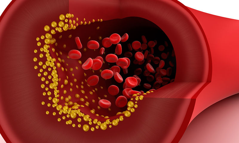 Χοληστερόλη: Τι πρέπει να προσέχω και πως να τρέφομαι