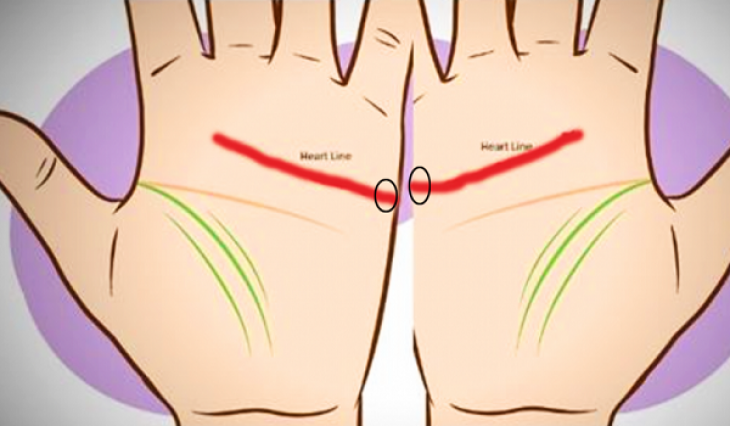 Έχετε αυτές τις γραμμές στη παλάμη σας; Δείτε τι σημαίνει (βίντεο)
