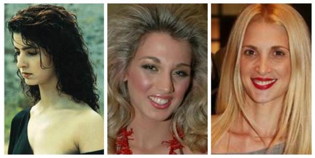 Ελληνίδες celebrities πριν και μετά την πλαστική μύτης (φωτο)