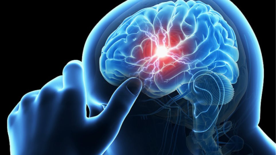 Τι είναι το «σιωπηλό» εγκεφαλικό επεισόδιο και πόσο επικίνδυνο είναι;