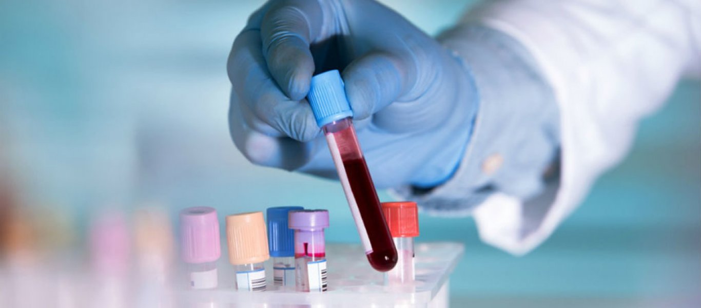 Ερευνητές ανακάλυψαν νέο τεστ αίματος που ανιχνεύει πάνω από 20 τύπους καρκίνου