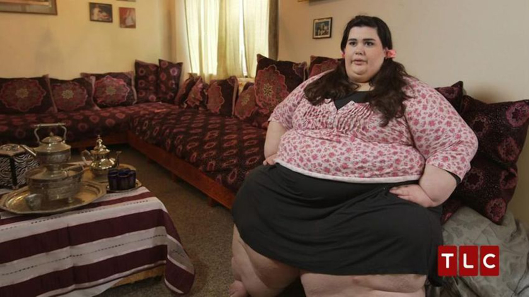 Ζύγιζε 292 κιλά: Οι γιατροί της είπαν πως θα πεθάνει – Η απίστευτη μεταμόρφωση (φώτο)