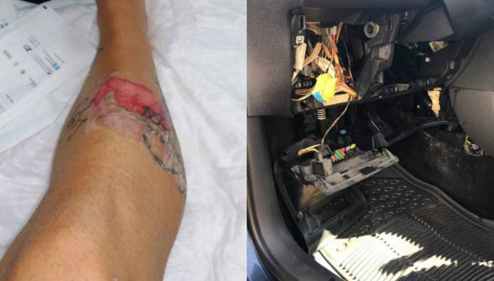 Απίστευτο- Καλοριφέρ περιπολικού «έσκασε» στα πόδια αστυνομικού (φώτο)