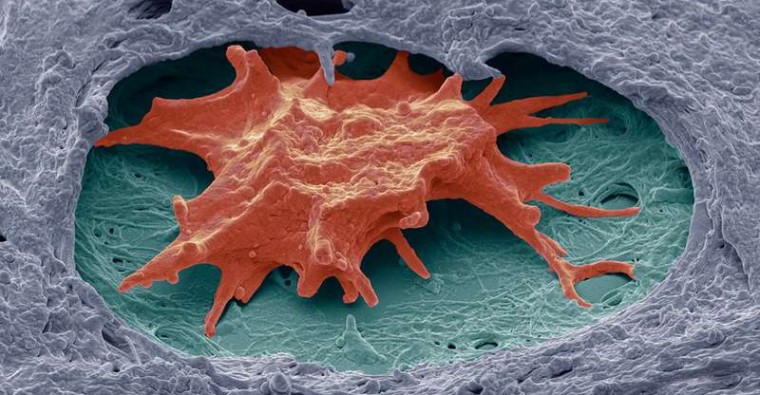 Αυτές οι θεραπευτικές τεχνικές χαρίζουν ποιότητα ζωής στις γυναίκες