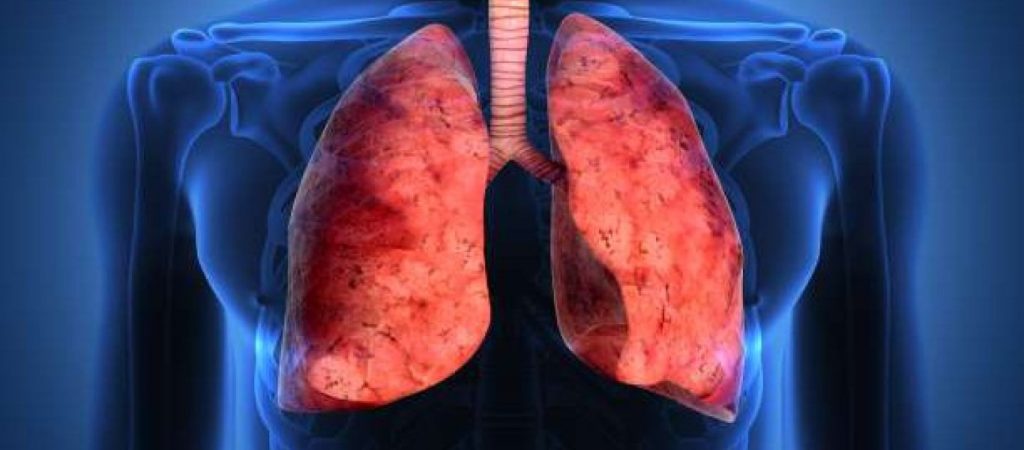 «Έξυπνη» μπλούζα παρακολουθεί τη λειτουργία των πνευμόνων