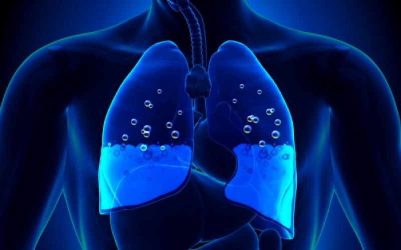 Αυτά τα συμπτώματα δείχνουν υγρό στον πνεύμονα