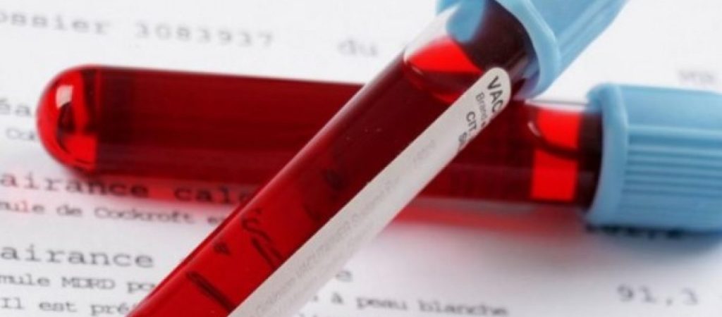 Δείτε πώς μπορείτε να αυξήσετε τη φερριτίνη μέσω της διατροφής