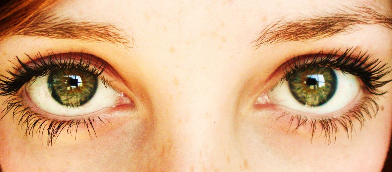 Κίτρινα μάτια: Προσοχή στην ανεβασμένη χολερυθρίνη – Τι πρέπει να γνωρίζετε