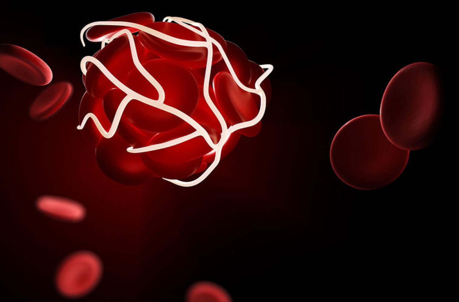 Έξι σημάδια που σας προειδοποιούν ότι έχετε θρόμβους στο αίμα σας