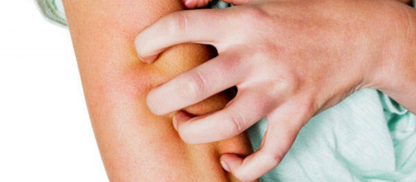 Φαγούρα στο σώμα: Για ποιους λόγους μπορεί να συμβαίνει;