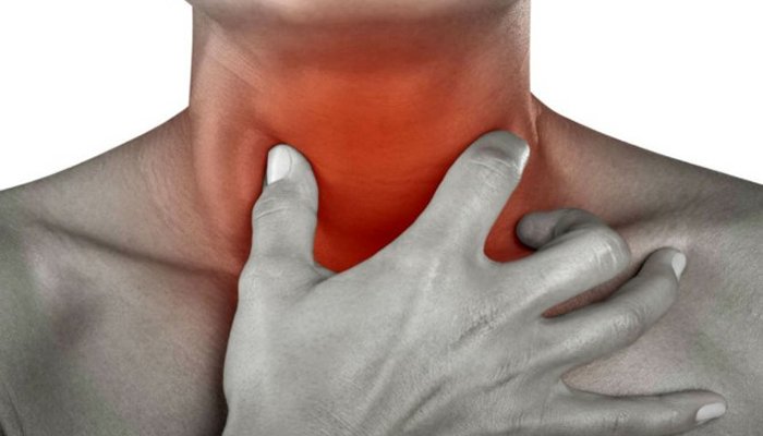 Ποια συμπτώματα δείχνουν καρκίνο στον λαιμό και όχι ίωση;