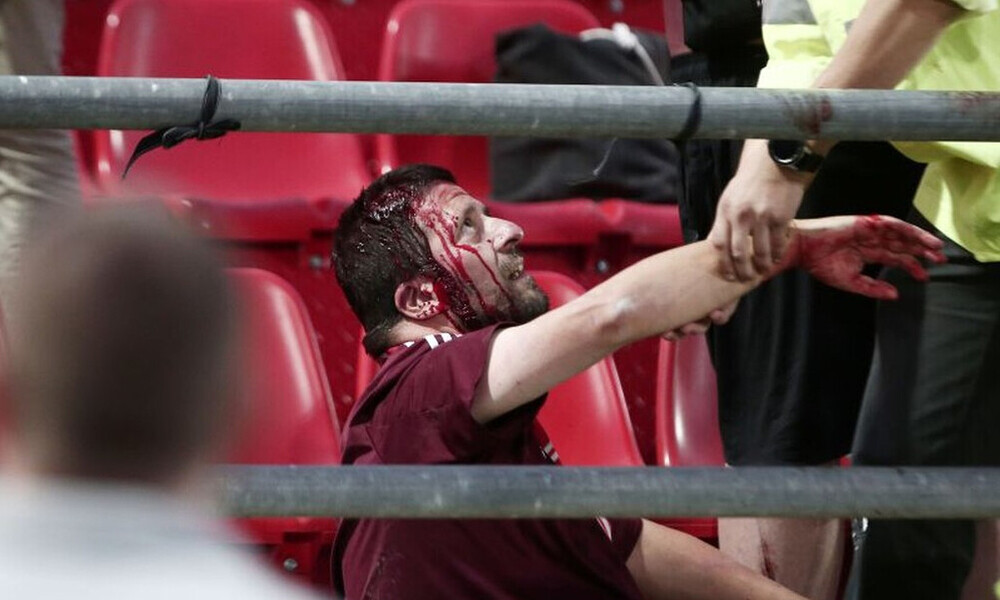 Καταγγελία της Μπάγερν για τον αγώνα του Ρέντη – Τι απαντά η UEFA