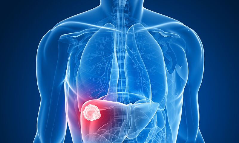 Έτσι θα καθαρίσετε το συκώτι σας – Απαλλαγείτε από τις πέτρες με αυτόν τον τρόπο