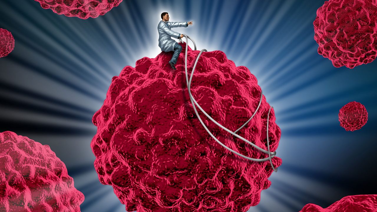 Bρέθηκε το τεστ αίματος που ανιχνεύει τον καρκίνο πέντε χρόνια πριν την εμφάνισή του;