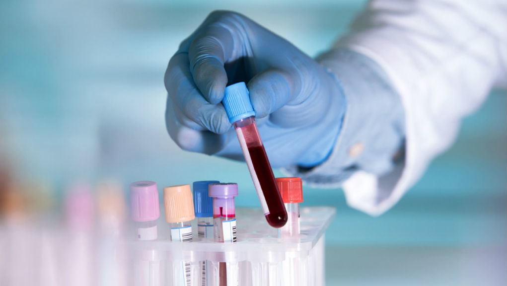 Το τεστ αίματος που ανιχνεύει τον καρκίνο