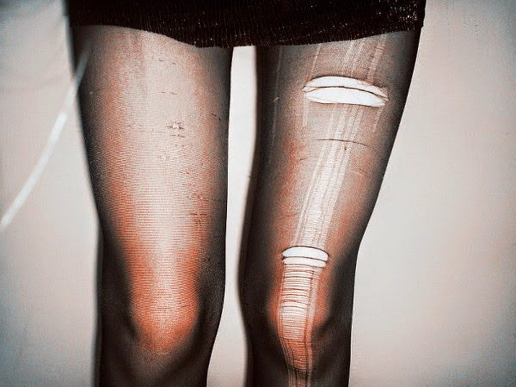 Που θα σας φανεί χρήσιμο το σκισμένο καλσόν