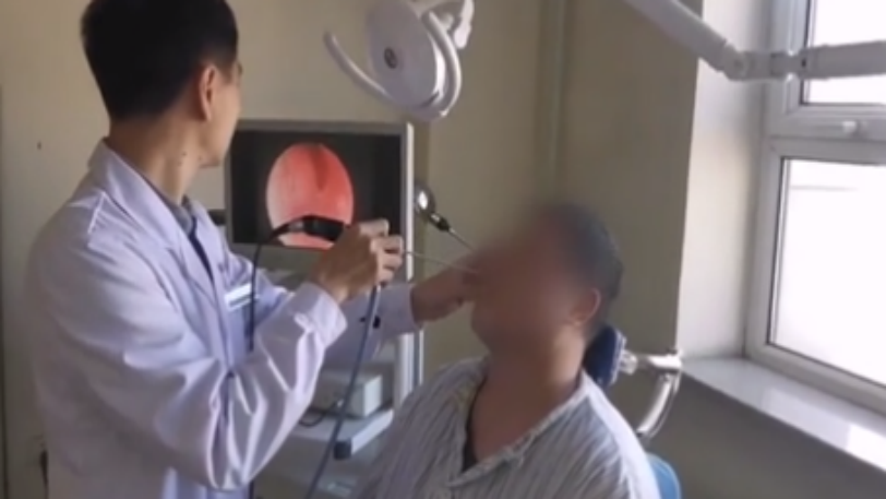 Άνδρας ανακάλυψε ότι είχε ένα δόντι μέσα… στο ρουθούνι του για 20 χρόνια (βίντεο)