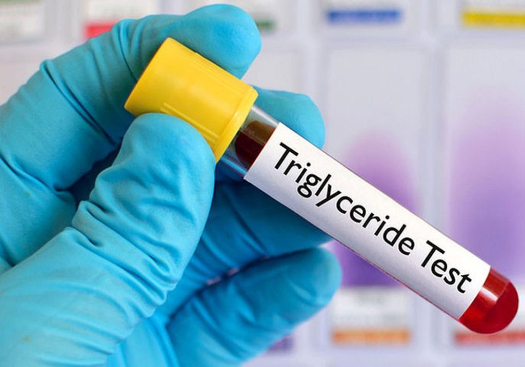 Mε ποια διατροφή θα ρίξετε την χοληστερίνη σας;