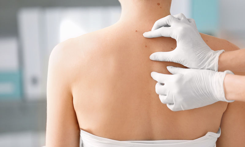 Γιατί το δέρμα μας είναι ευερέθιστο; – Ποια αιτία υπάρχει πίσω από αυτό;