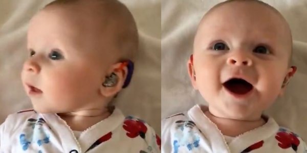 Δείτε τη στιγμή που ένα μωρό ακούει για πρώτη φορά τη φωνή της μητέρας του (βίντεο)