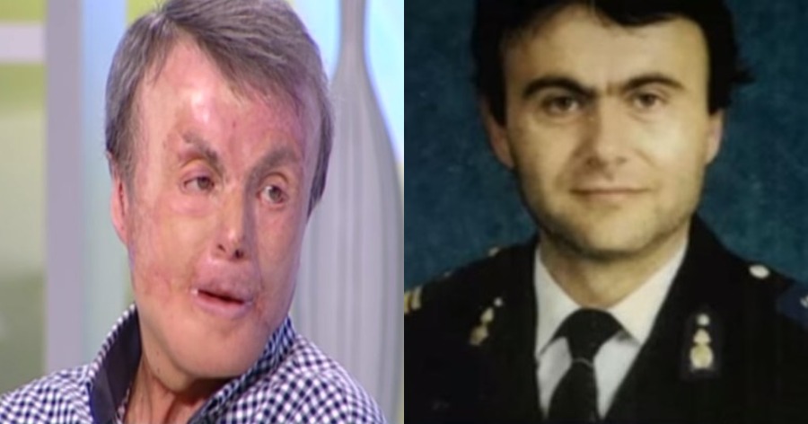 Ο Έλληνας πυροσβέστης που έσωσε συναδέρφους του από τη φωτιά, οι 100 μέρες στην εντατική και τα 18 χειρουργεία (βίντεο)