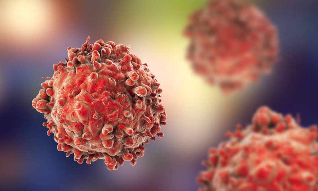 Επιστήμονες ανέπτυξαν σύστημα τεχνητής νοημοσύνης με αξιόπιστες διαγνώσεις λευχαιμίας