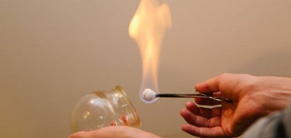 Η γιαγιά ξέρει: 8 γιατροσόφια των ’90s που αν τα έχεις δοκιμάσει είσαι τυχερός που ζεις