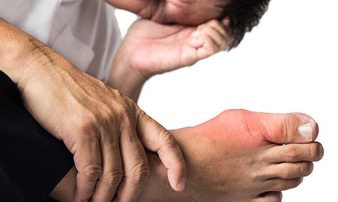 Ποιες τροφές οδηγούν σε αύξηση του ουρικού οξέως;