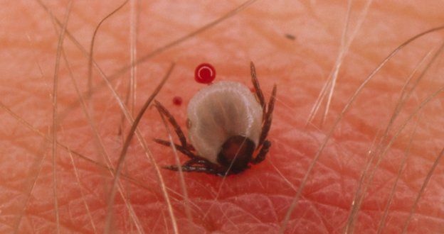 Τι είναι η Νόσος του Lyme από την οποία προσβλήθηκε ο Τζάστιν Μπίμπερ
