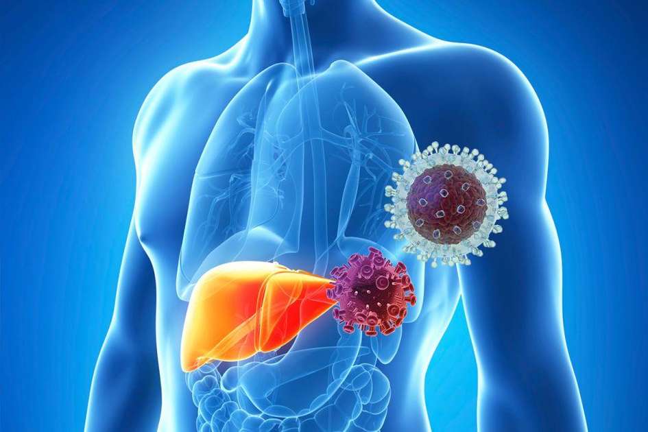 Hπατίτιδα C: Ποια τα συμπτώματα στο συκώτι; (βίντεο)