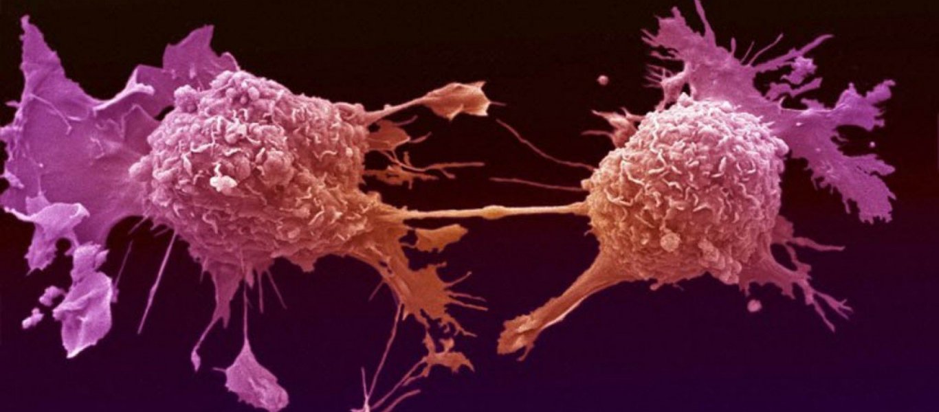 Αυτά είναι τα 4+1 προειδοποιητικά σημάδια που φανερώνουν καρκίνο – Δείτε τι πρέπει να κάνετε