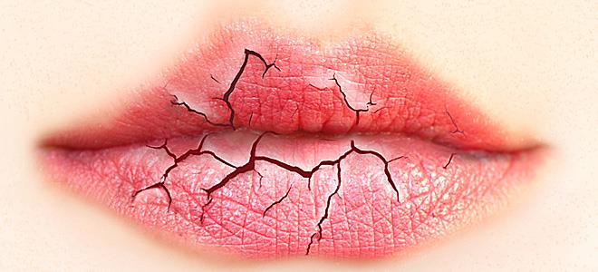 Τι παθήσεις μπορεί να κρύβει η ξηροστομία;