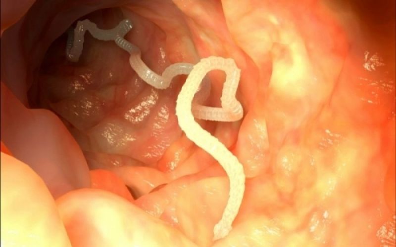 Τα σημάδια που δείχνουν σκουλήκι στο έντερο ή στο στομάχι