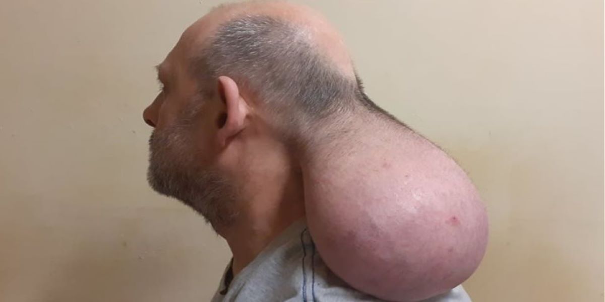 Κρατούμενος καταγγέλλει πως έβγαλε «δεύτερο κεφάλι» από χτύπημα αστυνομικού (φώτο – βίντεο)
