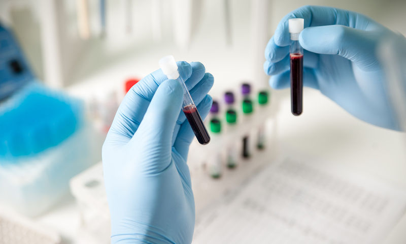 Το τεστ αίματος που προβλέπει πότε θα σταματήσει η έμμηνος ρύση