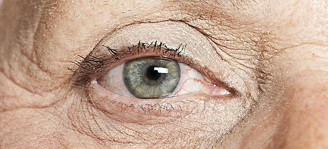 Γλαύκωμα: Έρευνα αποκαλύπτει νέες θεραπευτικές μεθόδους