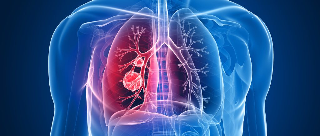 Αυτές είναι οι 6+1 τροφές «φάρμακο» για τους πνεύμονες