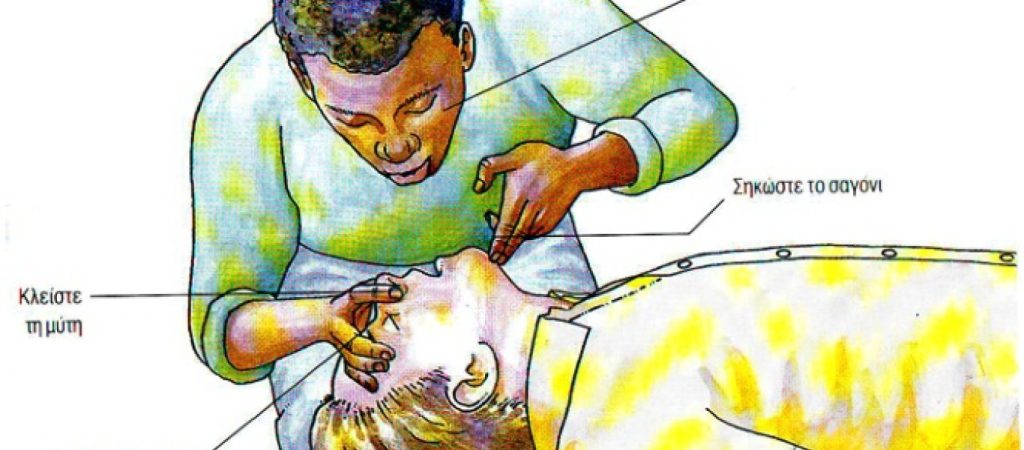 Τι να κάνετε αν σας «κάτσει κάτι στον λαιμό» – Πρώτες βοήθειες (βίντεο)