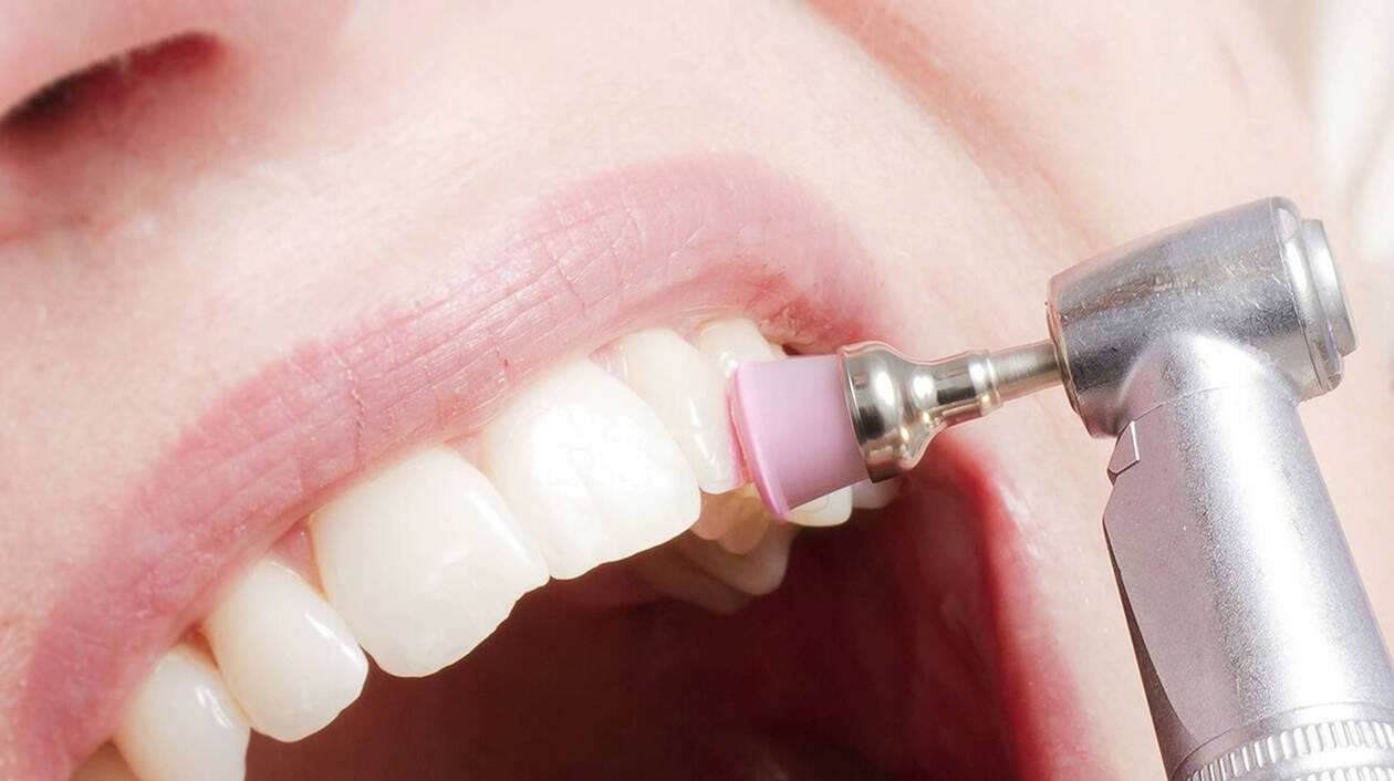 Έτσι θα αφαιρέσετε την οδοντική πλάκα χωρίς να πάτε στον οδοντίατρο