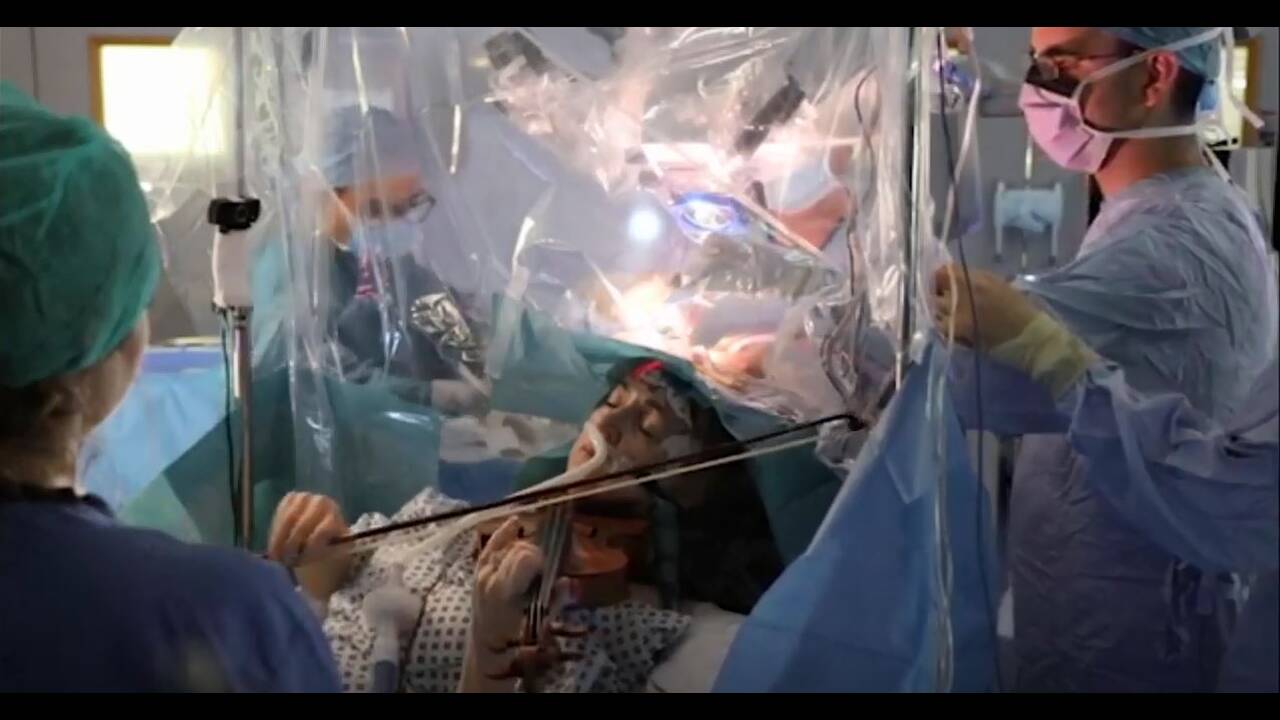 Εντυπωσιακό: Ασθενής έπαιζε βιολί την ώρα που εγχειριζόταν στον εγκέφαλο (φώτο-βίντεο)