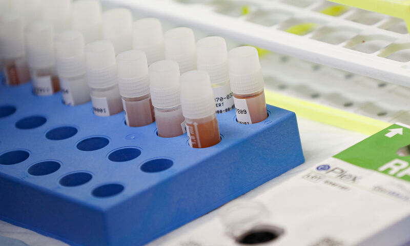 Ιράν: «Κυκλοφορούμε φάρμακο για τον κορωνοϊό μέσα στις επόμενες 7 – 10 ημέρες»