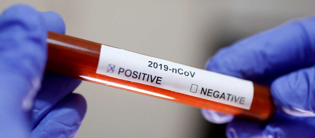 Δείτε αναλυτικά τι προβλέπει η ΠΝΠ για τον κορωνοϊό – Όλα τα έκτακτα μέτρα που «ενεργοποιούνται»