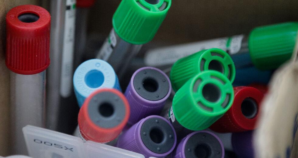 «Πράσινο φως» από τους Αμερικανούς σε τεστ που δίνει αποτέλεσμα για τον κορωνοϊό σε 45 λεπτά