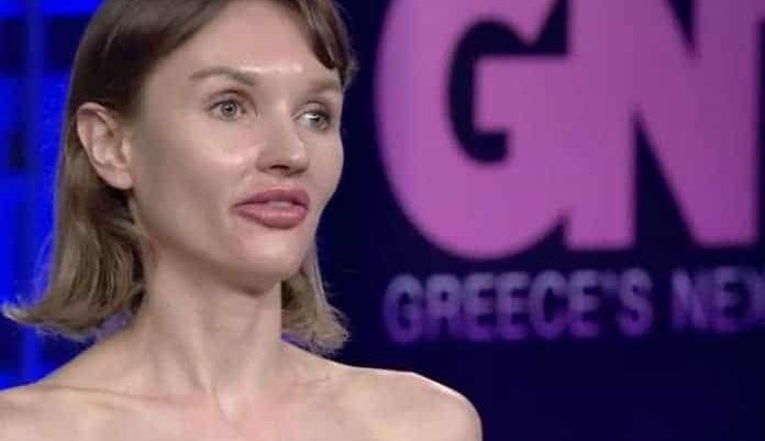 Συνέχισε τις πλαστικές: Η Αλιόνα του GNTM σήμερα είναι άλλη γυναίκα (φωτο)