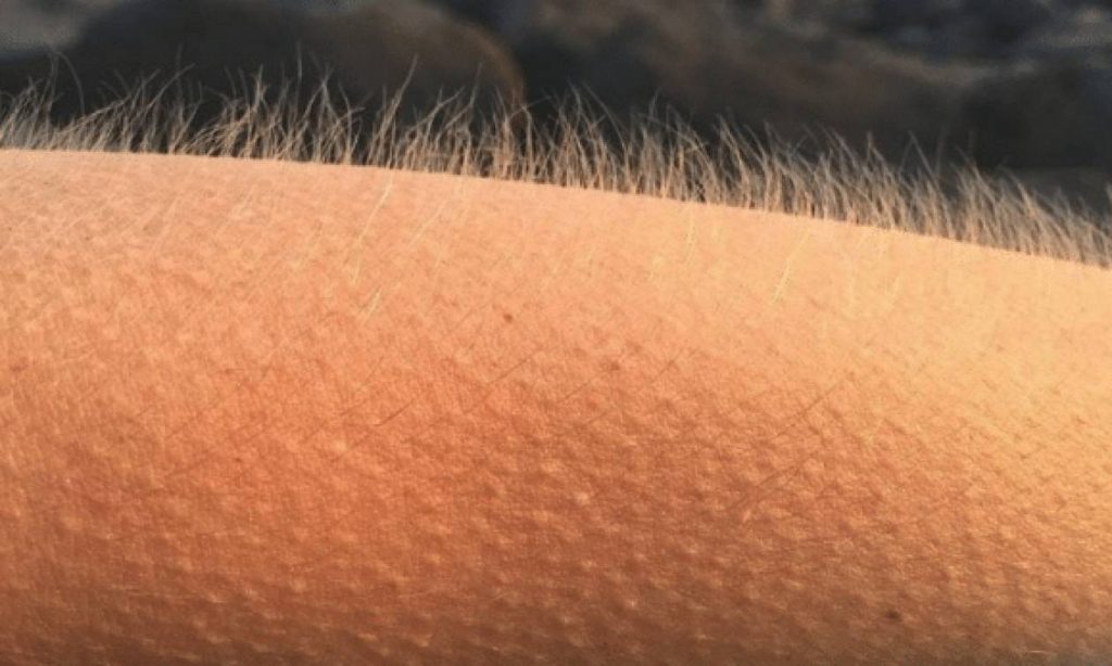 Το γνωρίζατε; – Γιατί σηκώνονται οι τρίχες μας όταν ανατριχιάζουμε; (βίντεο)