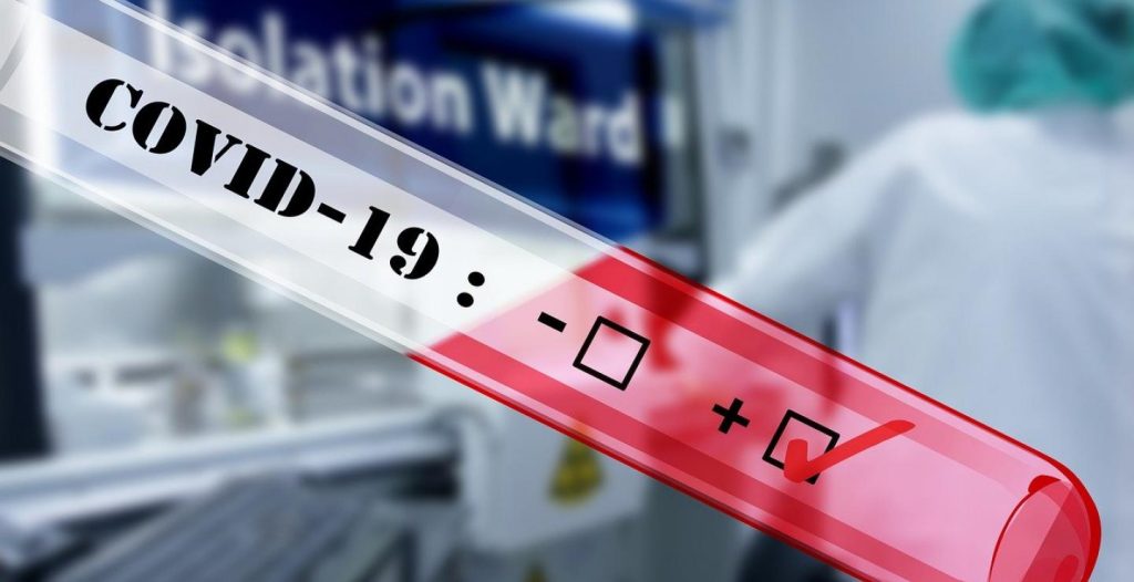 Κύπρος: Καταγράφηκαν 19 νέα κρούσματα κορωνοϊού