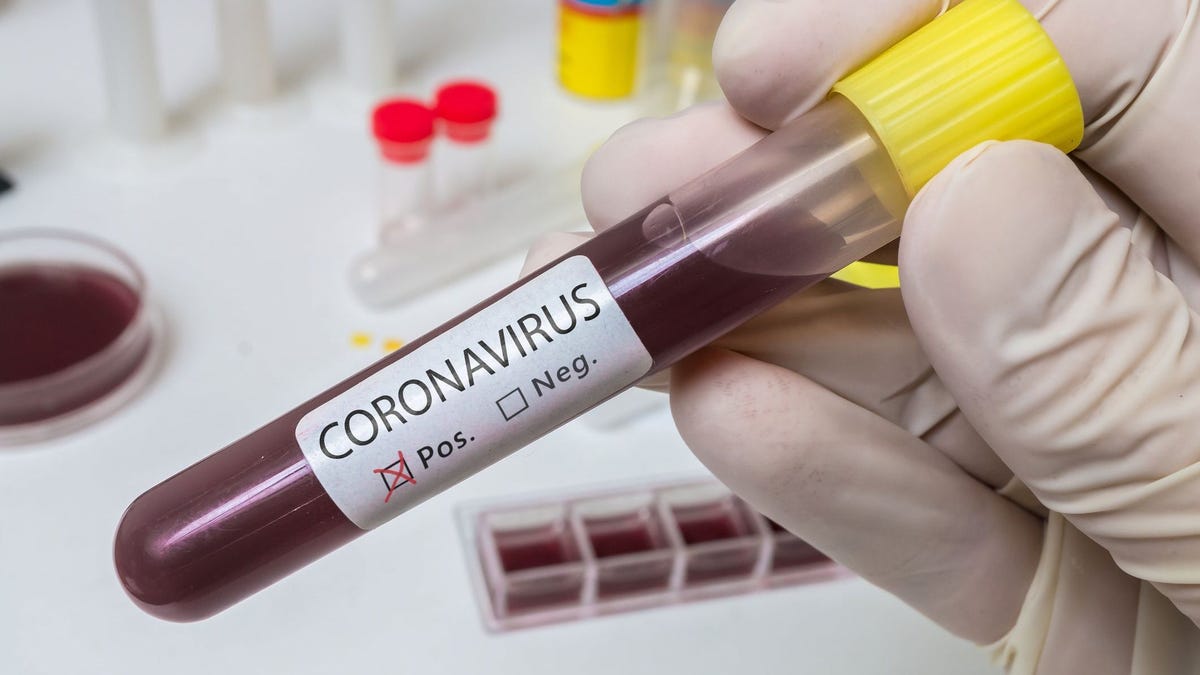 «Remdesivir»: Το φάρμακο που «γεννά» ελπίδες για την καταπολέμηση του κορωνοϊού – Όσα πρέπει να γνωρίζετε