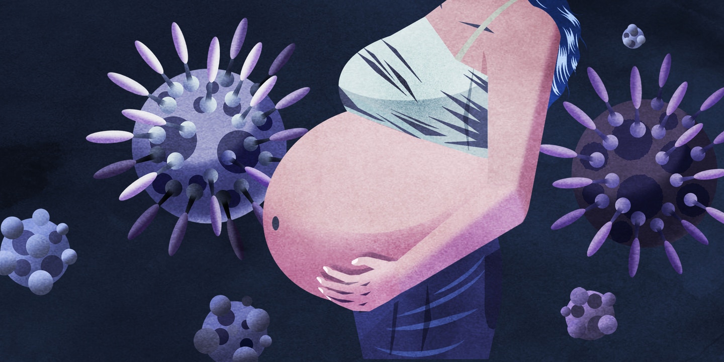 Κορωνοϊός: Έγκυος θετική στον ιό πέθανε κατά τη διάρκεια της γέννας – Αρνητικό το μωρό